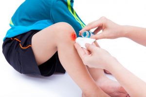 在家里，实用的8种快速有效的止血方法